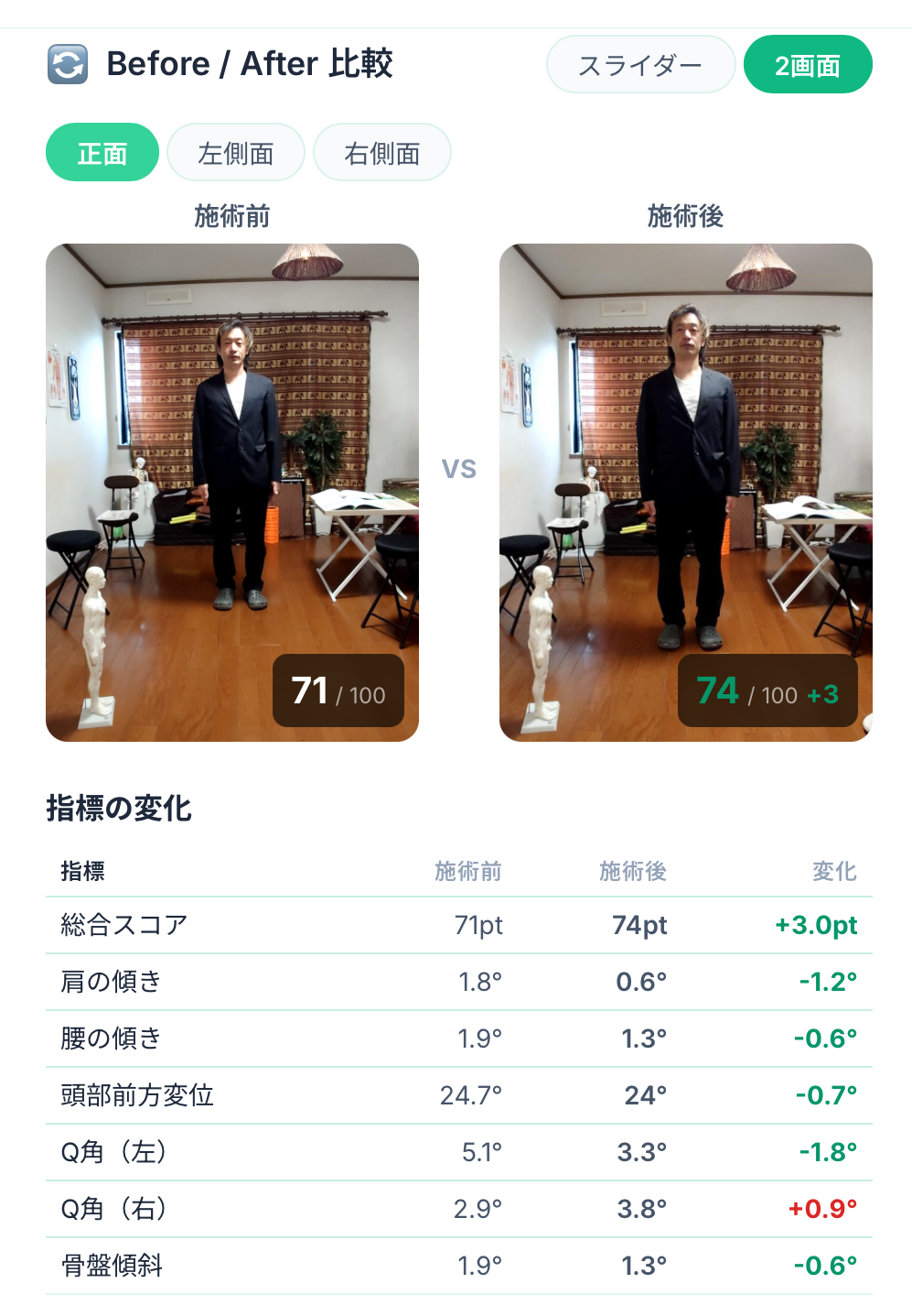 正面のBefore/After比較